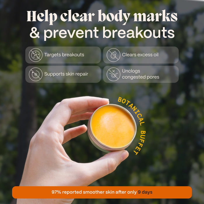 Body Balm for Acne-Prone Skin