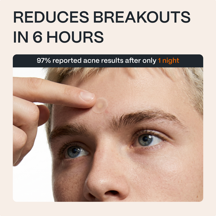 Man wearing a Norse Organics acne patch on his forehead beside a 6-hour results graphic